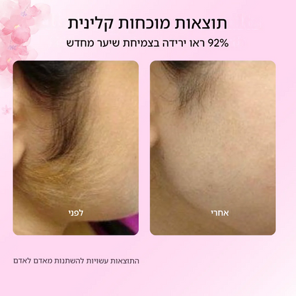 שמן השורשים של - ZEVININ