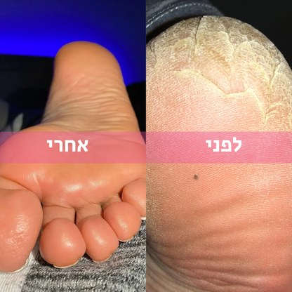 מכונת הפדיקור של - ZEVININ